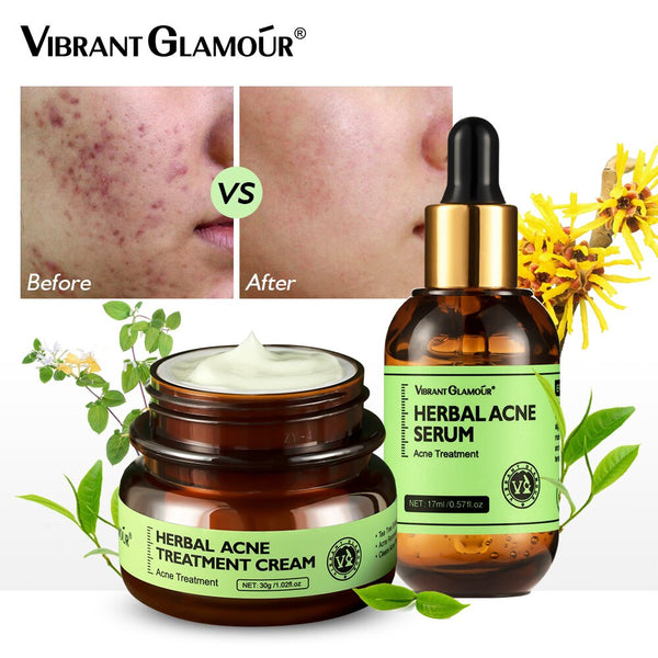 VIBRANT GLAMOUR Herbal Acne Face Cream & Serum